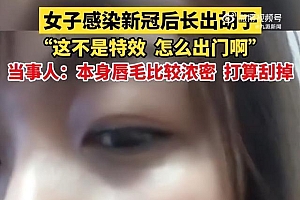 女生回应感染新冠后长出胡子:不是特效 没法出门