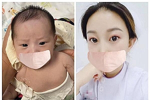 新生儿出生八天被确诊患罕见病:慢性肉芽肿