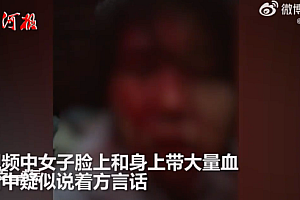 听障女子遭公公家暴满脸血迹画面静心 警方回应:人没事