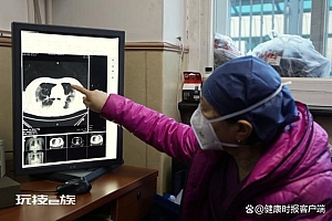 肺部CT需求暴增 检出率约10%-20% 专家:即使肺部出现炎症也并非都为危急重症