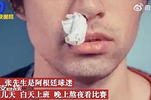男子见阿根廷输球血压爆表鼻血狂喷 血亏了能不流血吗?