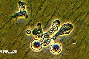 韩国报告首例“食脑虫”病例 从泰国回国后死亡