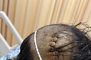 医生被刺5刀,家属:凶手疑被害妄想,刚从精神病院出院一个月