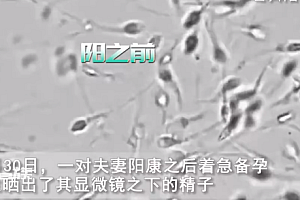 夫妻阳康后着急备孕医生劝阻 精子对比图让人惊诧