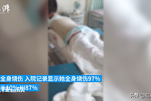 母亲称女儿拒绝追求被男孩泼汽油烧伤,凶手事后跳河自杀了