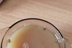 新冠感染初愈后可以大吃大喝吗  要对自己的身体负责切勿暴饮暴食