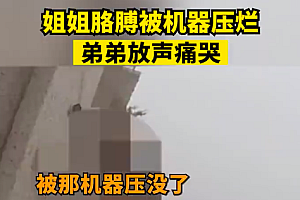 姐姐胳膊被机器压烂弟弟放声痛哭 希望胳膊被保住啊!