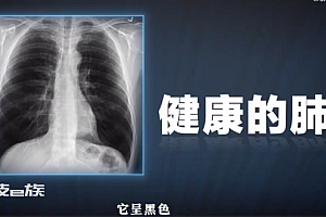 3分钟180秒拆解“白肺”六大疑问 救命三件套是什么你知道吗?