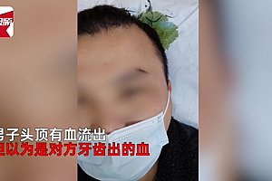 男子打球6天后发现头顶卡对手2颗牙 伤口腐臭缝4针