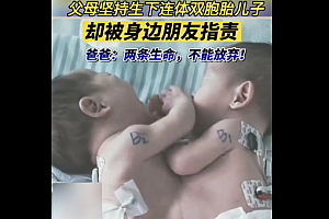 父母为省钱未做四维生下连体双胞胎  但巨额治疗费用让这个家庭雪上加霜
