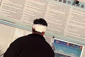 男子刚领证7天被妻子打伤进医院 如果还手就是另外一个版本了