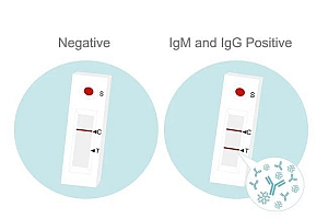 感染情况到底如何?北京将开展抗体调查进行风险评估