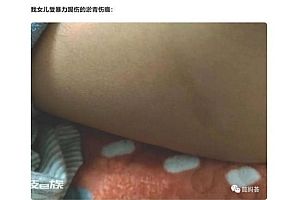 家长称女儿遭到校园暴力 多方正介入调查