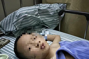 当事人回应放炮炸伤男孩致截肢:一场意外 有亲戚关系会负责到底
