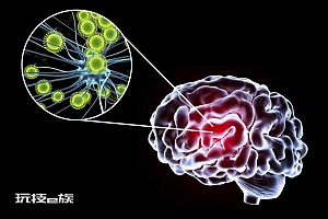 柜子里有人!九旬老人“阳康”后性情大变!新冠病毒损害神经