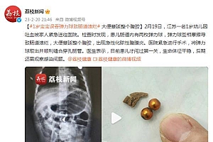 1岁宝宝误吞弹力球致肠道溃烂,大便蔓延整个腹腔