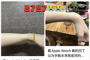 戴苹果手表,多人手腕变形?还出现疼痛症状,苹果官方回应