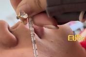 男子高烧近41度体温计贴脸狂飙 医生:他不是甲流