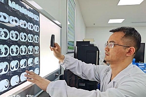 武汉一老烟民患肺性脑病 网友:这点多大瘾