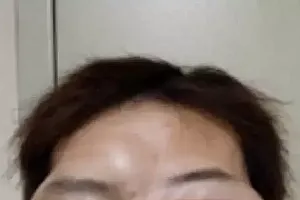 杭州已有人中招!把自己打到“面目全非”,只因……医生强调:千万别!