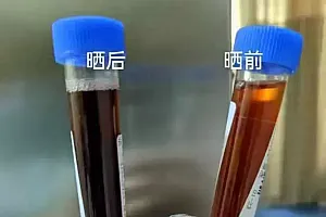 突然口吐黑水!25岁女生慌了……紧急提醒:出现这些症状,赶紧就医