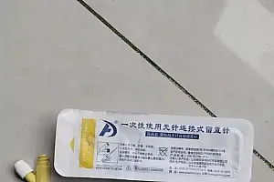 男婴输液时针头导管留体内5年,最近进展:已取出