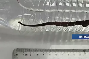 云南一孩子呼吸不畅,做雾化后竟咳出一条12厘米长活蚂蟥