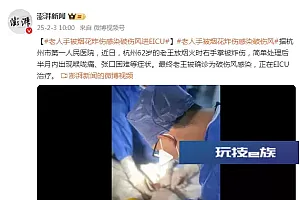 老人手被烟花炸伤感染破伤风进EICU