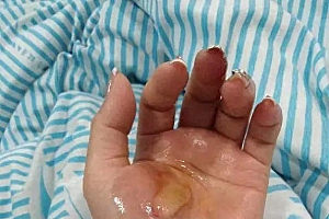 女子洗澡时被电,几秒就心脏骤停!专业人士提醒