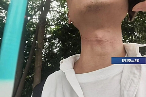 “人差点没了,已报警!”长沙男子骑行中遭风筝线勒喉,如何维权?律师提醒