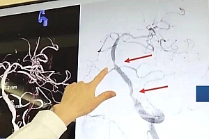 体感温度超40℃!小心“热中风”